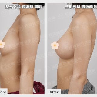 ALL_catalog_plasticsurgery_25L30_kYdfDTOVqg