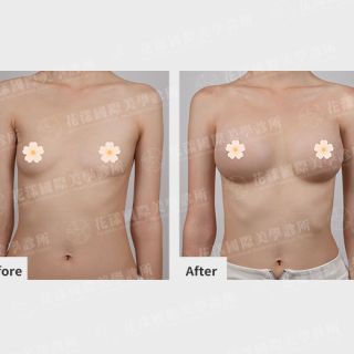 ALL_catalog_plasticsurgery_25L30_pjr2PMXa0T