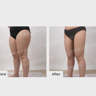 ALL_catalog_plasticsurgery_25L31_2YhSjymFU8