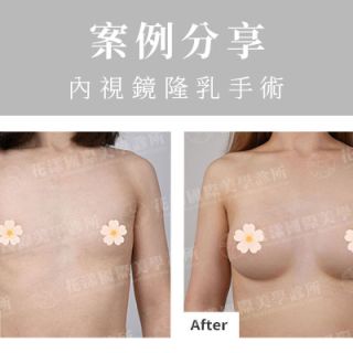 ALL_catalog_plasticsurgery_26A27_KGlmbQr2Hx