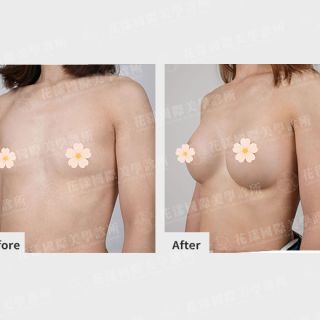 ALL_catalog_plasticsurgery_26A27_kNUPY8iW0z