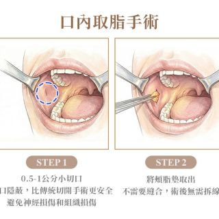 ALL_catalog_plasticsurgery_26B05_40o52px5O5