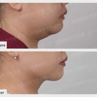 ALL_catalog_plasticsurgery_26B13_icRFYOUuk2