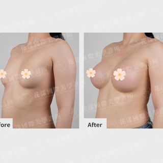 ALL_catalog_plasticsurgery_26D07_4lFpusSeZK