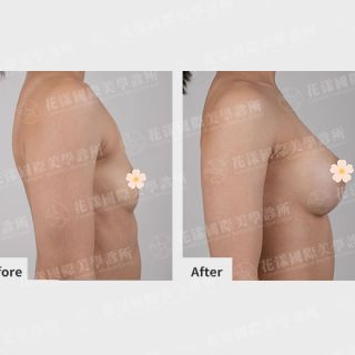 ALL_catalog_plasticsurgery_26D07_AsvjpEmUV0