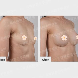 ALL_catalog_plasticsurgery_26D07_Eevuxqhomf