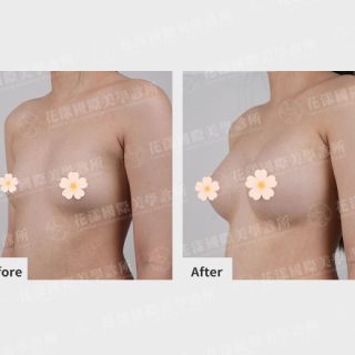 ALL_catalog_plasticsurgery_26D07_Hw8gKg7zJw