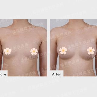 ALL_catalog_plasticsurgery_26D07_KmSZSACvaB