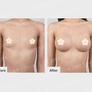 ALL_catalog_plasticsurgery_26D07_OvHLTzlQcN