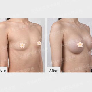 ALL_catalog_plasticsurgery_26D07_zToQDYUro6