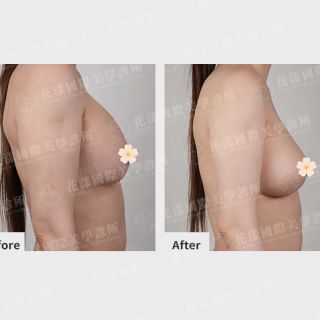 ALL_catalog_plasticsurgery_26D08_Y6af93ilHk