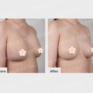 ALL_catalog_plasticsurgery_26D08_YJ40ohfW1P