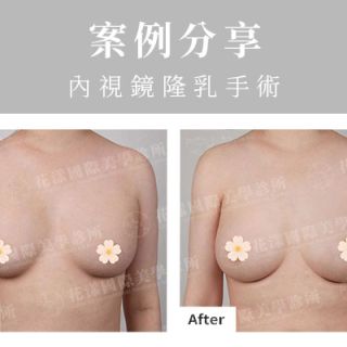 ALL_catalog_plasticsurgery_26D08_tphYnRNEzw