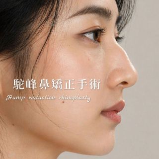 ALL_catalog_plasticsurgery_26D30_uPy0c7NiN8
