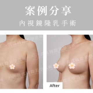 ALL_catalog_plasticsurgery_26G10_J6Sni2MNDd