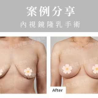 ALL_catalog_plasticsurgery_26G10_dW7y0ZR9bS