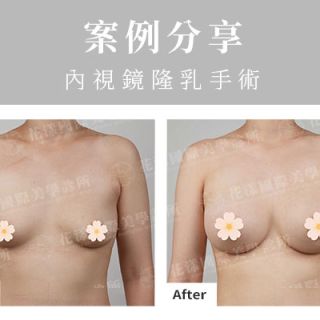 ALL_catalog_plasticsurgery_26G10_jkFZ9y7oY5