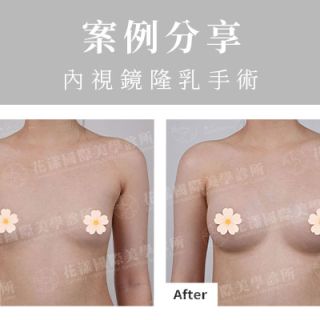 ALL_catalog_plasticsurgery_26G10_kx9u1REs45