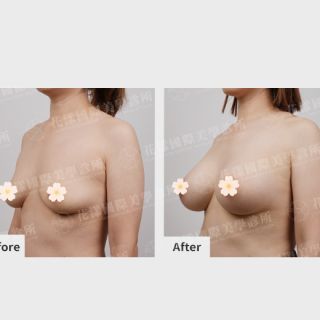 ALL_catalog_plasticsurgery_26G31_7nSXh75RM5
