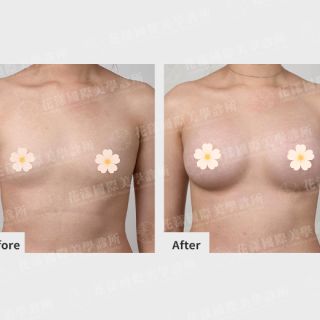 ALL_catalog_plasticsurgery_26G31_8hFY2A5Don