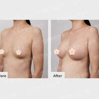 ALL_catalog_plasticsurgery_26G31_Pc1ucikTHn