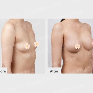 ALL_catalog_plasticsurgery_26G31_aRG8yLAqJP