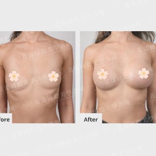 ALL_catalog_plasticsurgery_26G31_brAWrnZwz8