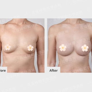 ALL_catalog_plasticsurgery_26G31_jGjwcsAvBt