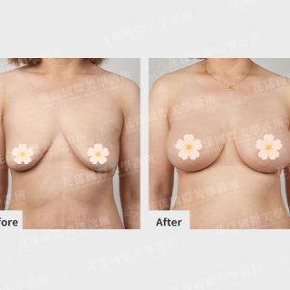 ALL_catalog_plasticsurgery_26G31_kIl3AHGsSy
