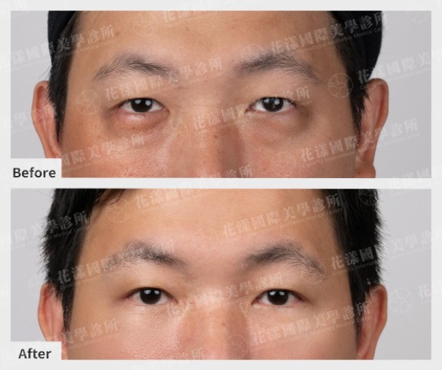 twL_catalog_plasticsurgery_25F30_M6h3C4RTbb