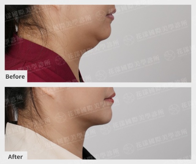 twL_catalog_plasticsurgery_25J08_w7it7xlGRJ