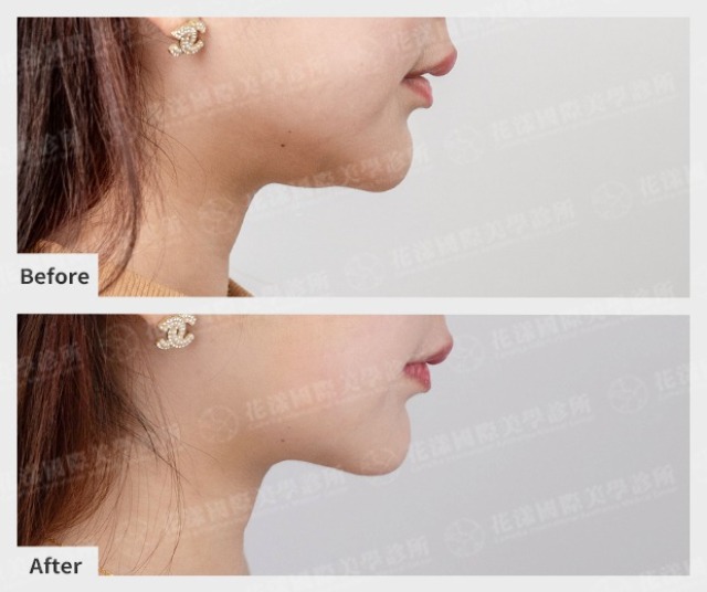 twL_catalog_plasticsurgery_25J08_wxPpe9kJRb