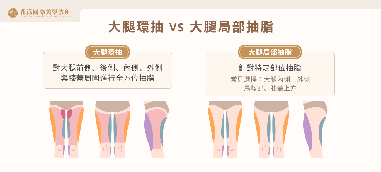 大腿環抽 VS 大腿局部抽脂