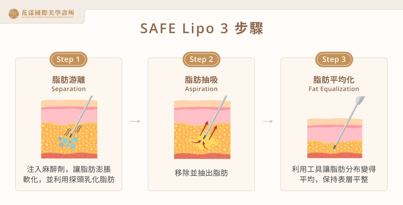 SAFE Lipo 3 步驟