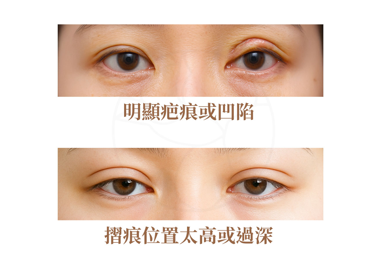 明顯的疤痕或凹陷