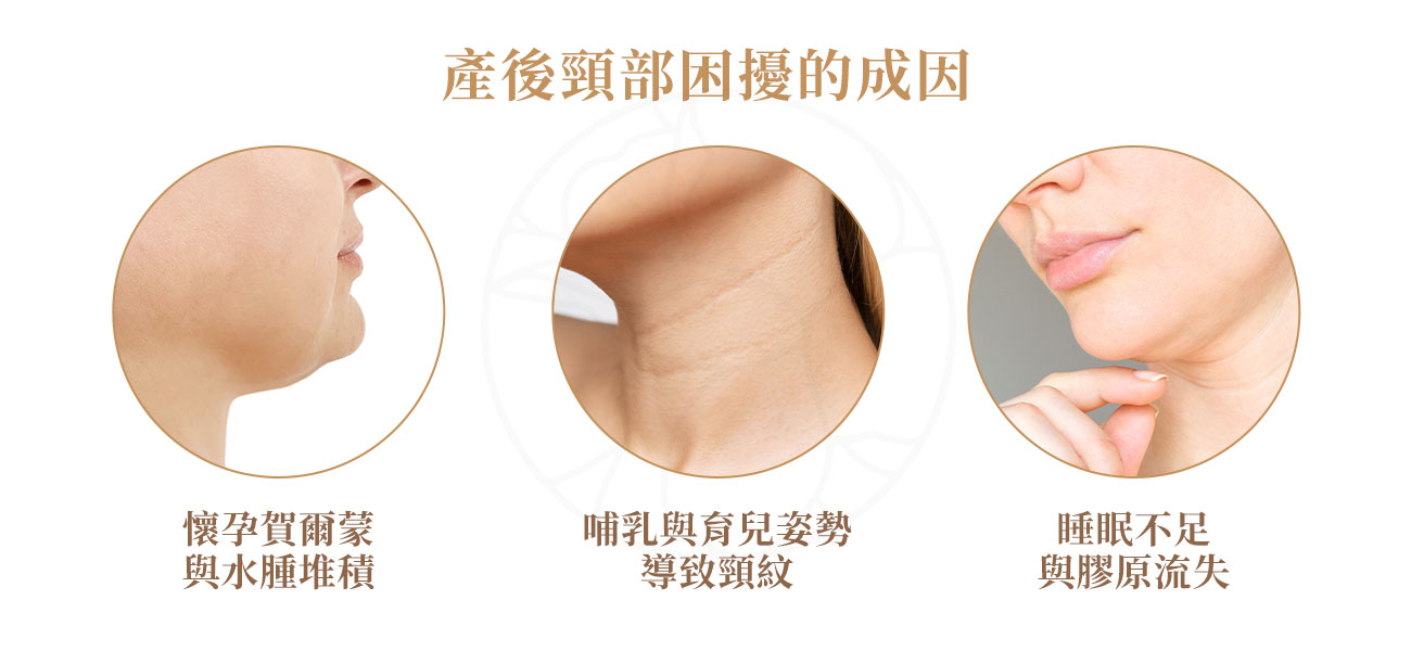 1.懷孕賀爾蒙與水腫堆積 2.哺乳與育兒姿勢導致頸紋 3.睡眠不足與膠原流失