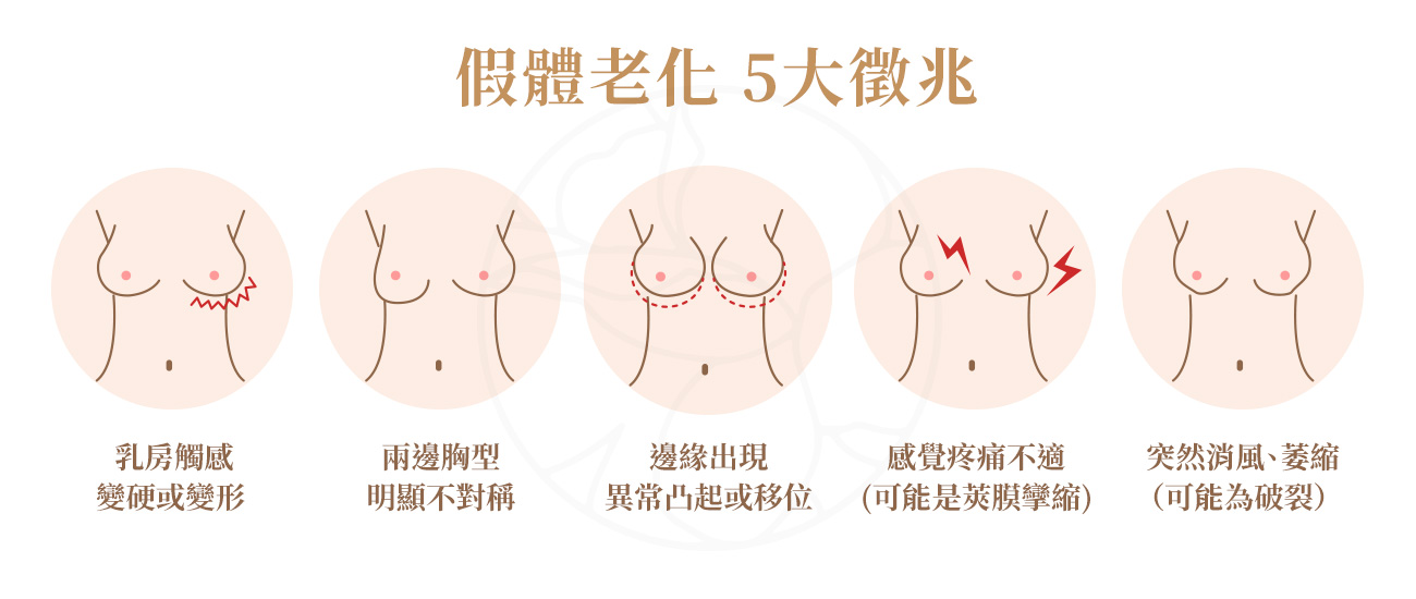 1.乳房觸感變硬或變形。2.兩邊胸型明顯不對稱。3.假體邊緣出現異常凸起或移位。4. 感覺疼痛、拉扯感或不適，可能是莢膜攣縮。5.胸部突然消風、萎縮（可能為破裂）。