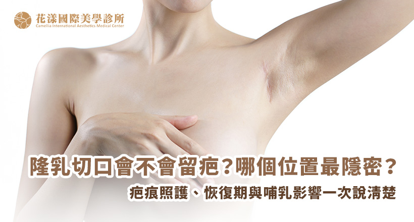 隆乳放哪一層最自然？乳腺下、筋膜下、胸大肌下、雙平面有什麼差別？本篇解析隆乳4大置入層次的優缺點、恢復期、自然度與適合對象，幫你找到最不痛、最穩定、最自然的選擇！