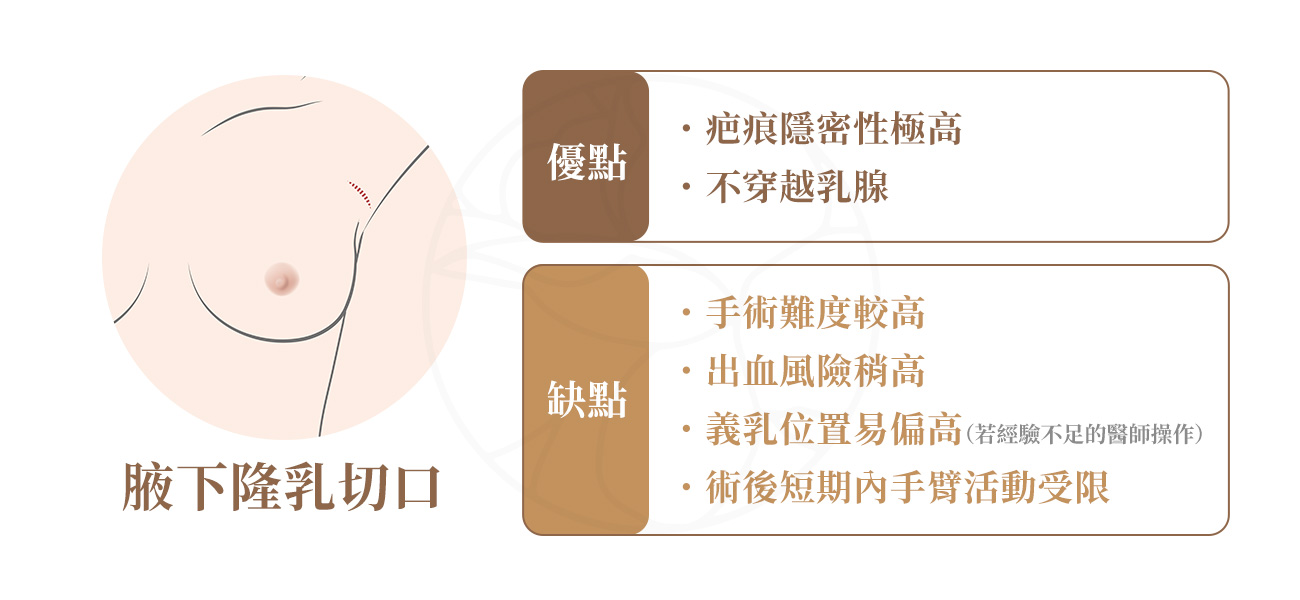 1.優點：疤痕隱密性極高 2.缺點：手術難度較高 3.適合族群： 對疤痕位置極度敏感、希望胸部完全無切痕者。 有哺乳需求者，想避免乳腺受損。