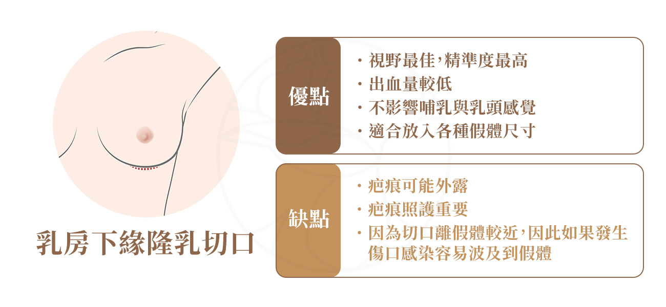 1.優點： 視野最佳，精準度最高 2.缺點：疤痕可能外露 3.適合族群： 對疤痕位置容忍度高