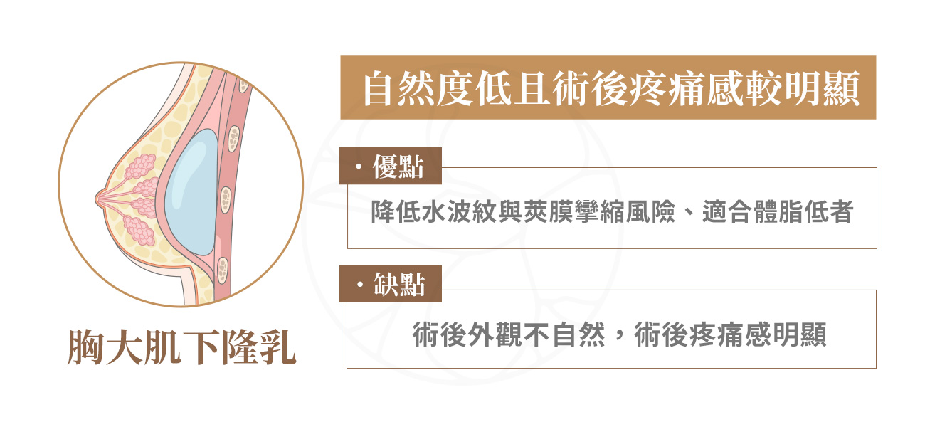 優點：降低水波紋與莢膜攣縮風險、適合體脂低者。缺點：術後外觀不自然，術後疼痛明顯