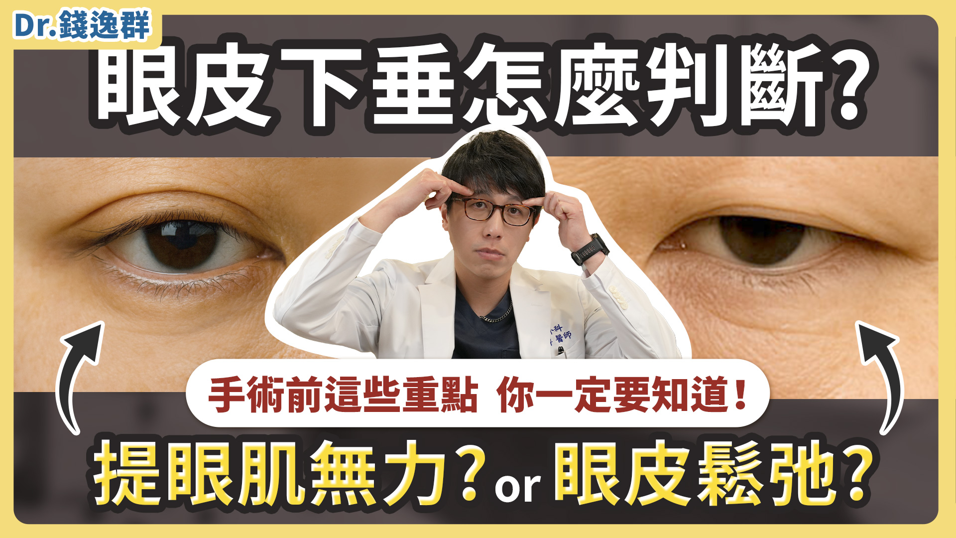 眼皮下垂？是提眼肌無力還是眼皮鬆弛？手術前這些重點你一定要知道
