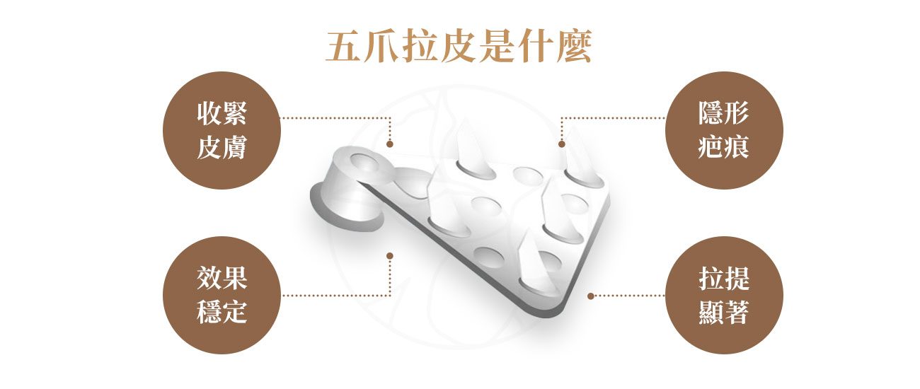 「五爪拉皮」常被誤以為是一種手術。五爪其實指的是五爪鉤（Endotine），是固定組織的工具之一。   五爪鉤（Endotine）是一種由可被人體吸收的聚乳酸製成的固定器，它像一個帶有５個小爪子的「隱形鉤子」。優點是，1.穩固提拉 2.人體可吸收