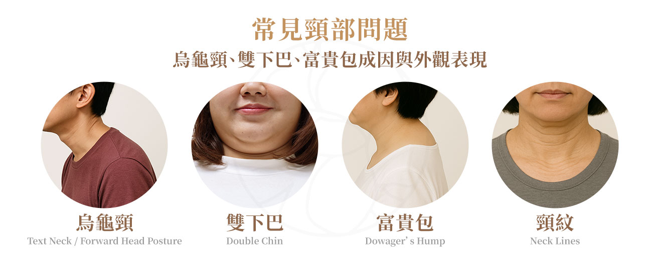 1.烏龜頸，頭部明顯前傾，下巴線條內縮，側面看像烏龜伸長脖子。2.雙下巴，下巴下方堆積脂肪，使得臉與脖子界線變的模糊。3.富貴包，第七頸椎處有明顯隆起，摸起來有點硬硬的，常伴隨肩頸厚重感。4.頸紋，頸部出現一條條橫紋，即使是年輕人也可能因低頭頻繁而加深。