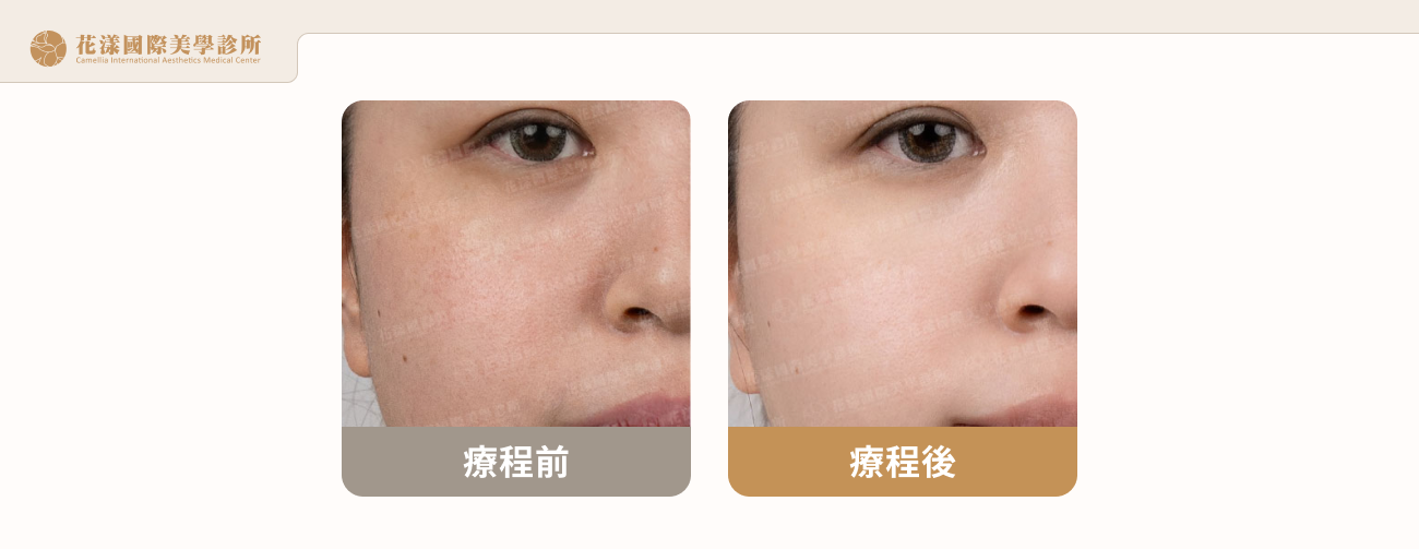 水飛梭好評案例 1-2