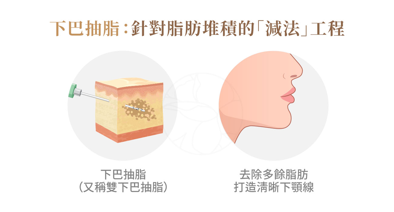 下巴抽脂：透過微小切口與細管抽脂技術，移除下巴與頸部交界處多餘的 淺層脂肪，達到修飾輪廓與減少雙下巴的效果。