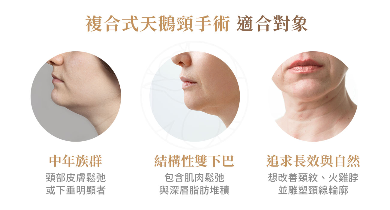 複合式天鵝頸手術適合對象1. 中年族群 2. 結構性雙下巴 3. 追求長效與自然線條者