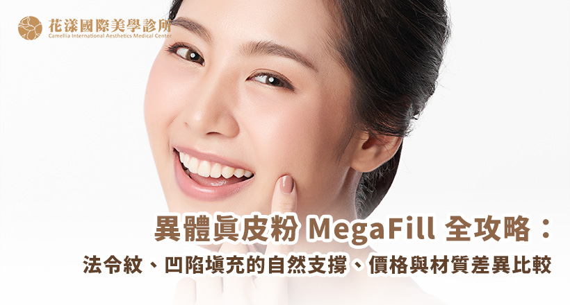 異體真皮粉 MegaFill 全攻略：法令紋、凹陷填充的自然支撐、價格與材質差異比較