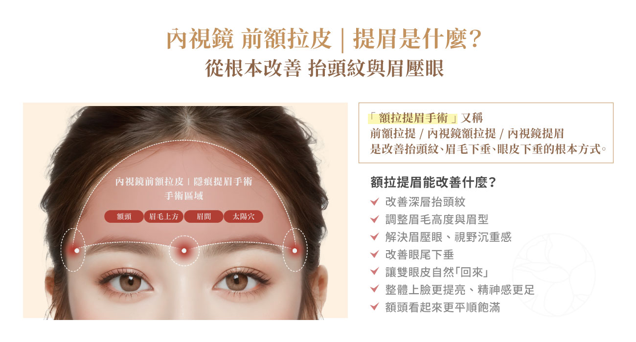 內視鏡額拉提眉(前額拉提)是什麼? 「額拉提眉手術」又稱 前額拉提 / 內視鏡額拉提 / 內視鏡提眉,是改善抬頭紋、眉毛下垂、眼皮下垂的根本方式
