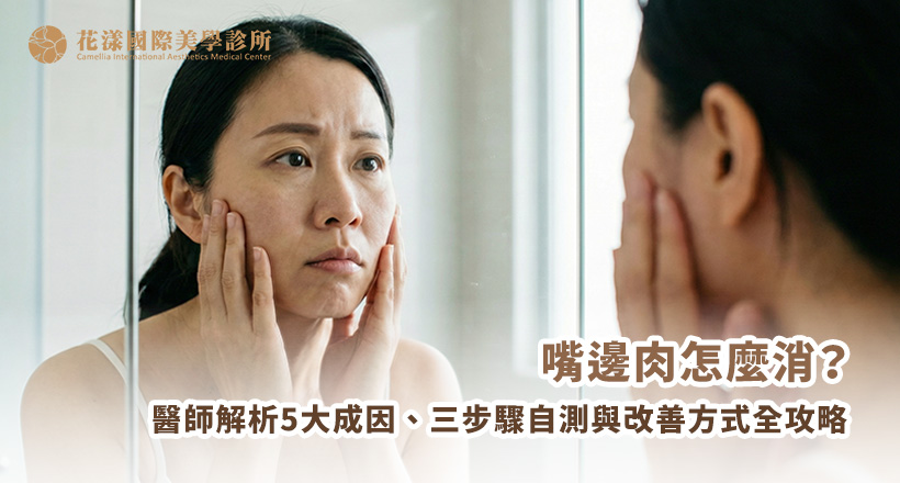 嘴邊肉怎麼消？醫師解析 5 大成因與類型：口內取脂、埋線拉提、音波電波到拉皮手術全攻略